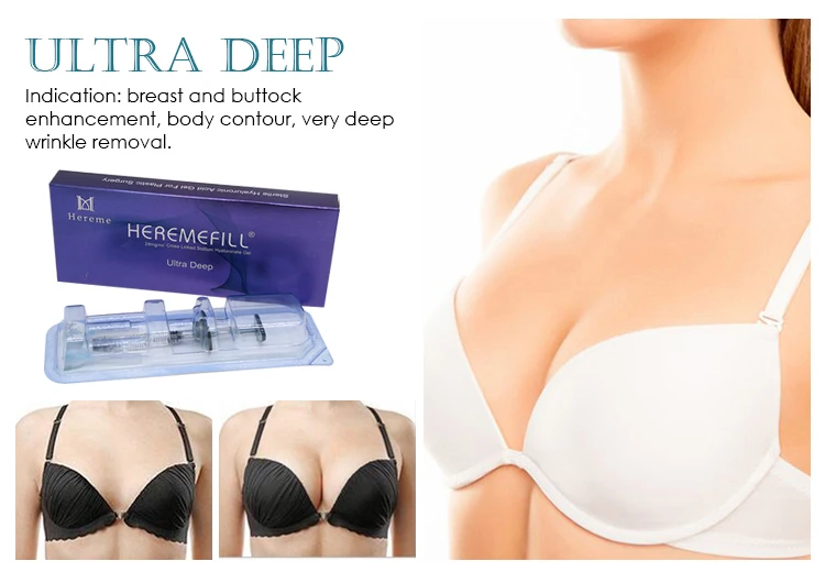 Wholesales Price 24mg/ML Ha Dermal Filler Injection Cross Linked Hyaluronic Acid Korea Dermal Filler