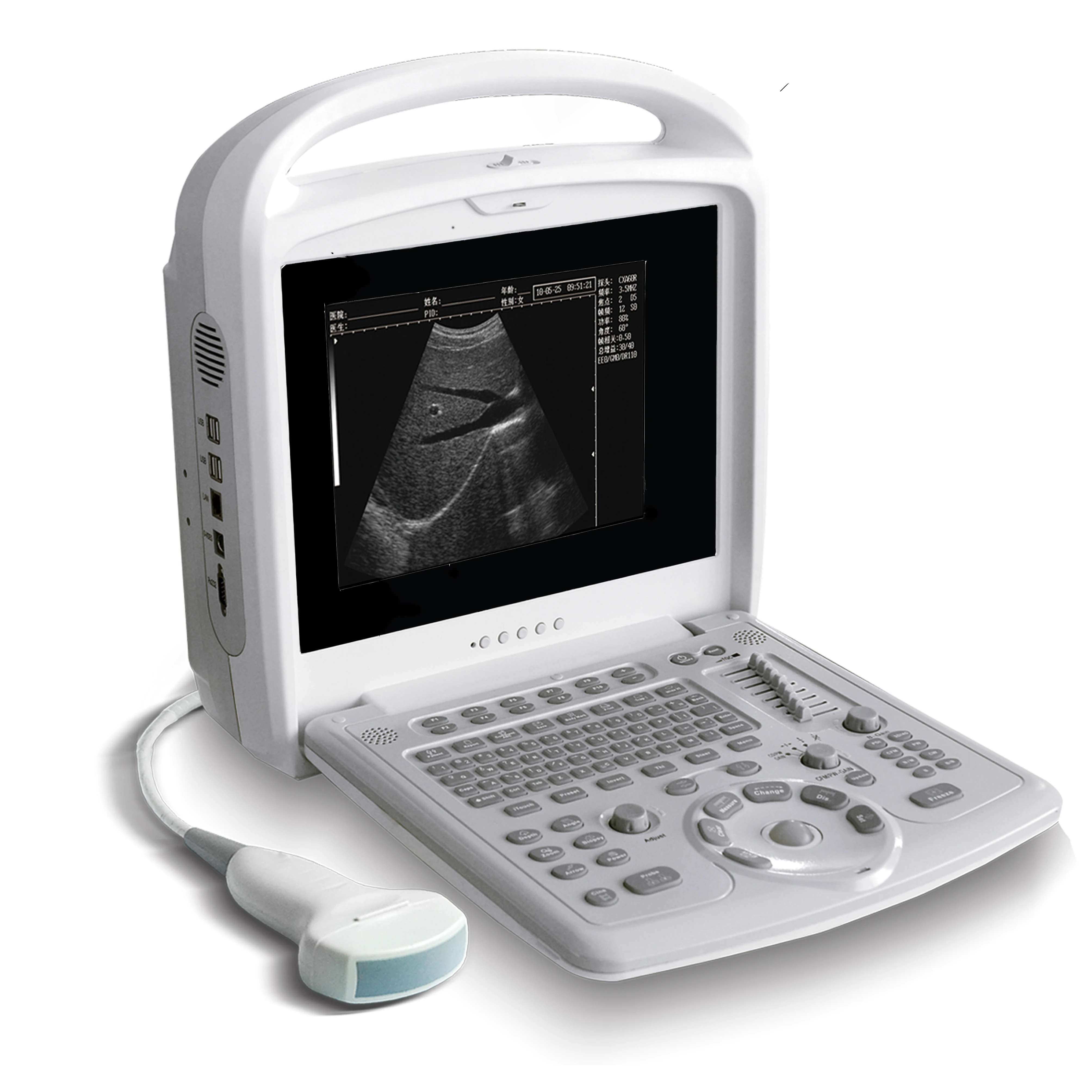 High quality portable ultrasound machine price portable ultrasound machine color doppler portable ultrasound machine price
