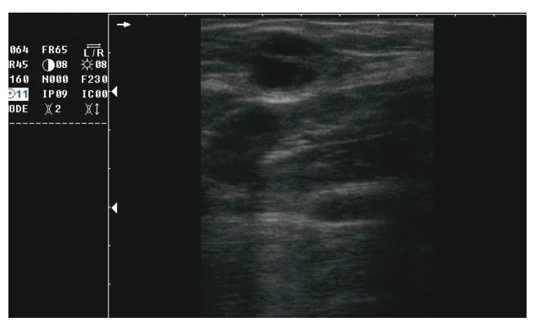 THR-V51A Low Price Handheld Veterinary Ultrasound Machine Animal Ultrasonic Diagnosis System