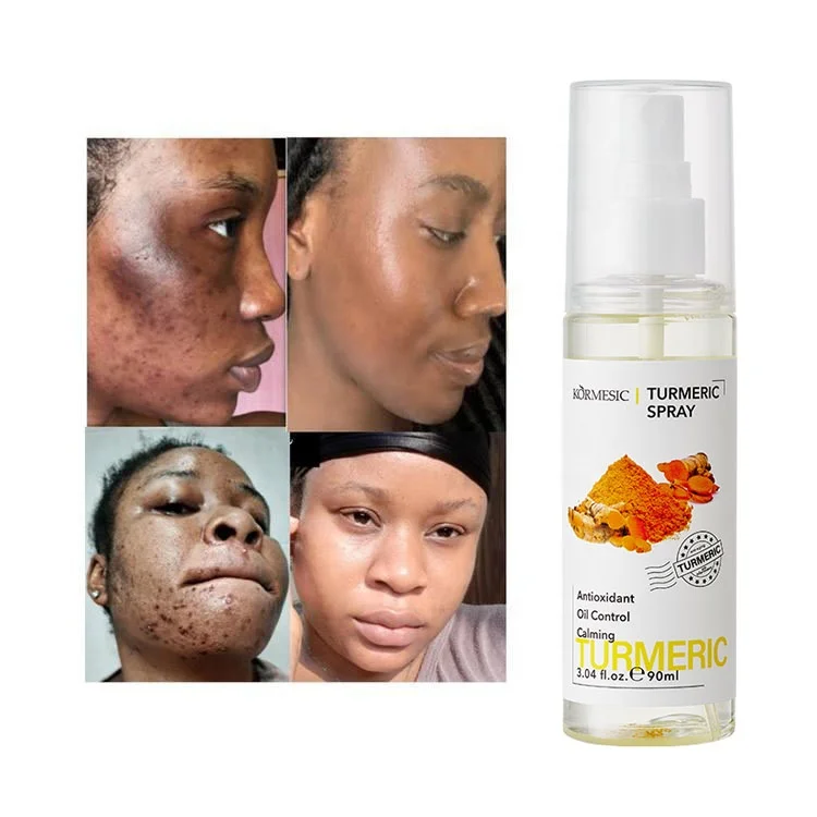 Natural Organic Turmeric Whitening Vitamin C Refershing Moisturizing Mint Facial Skin Care Skincare Moisturizing Face Skin Toner