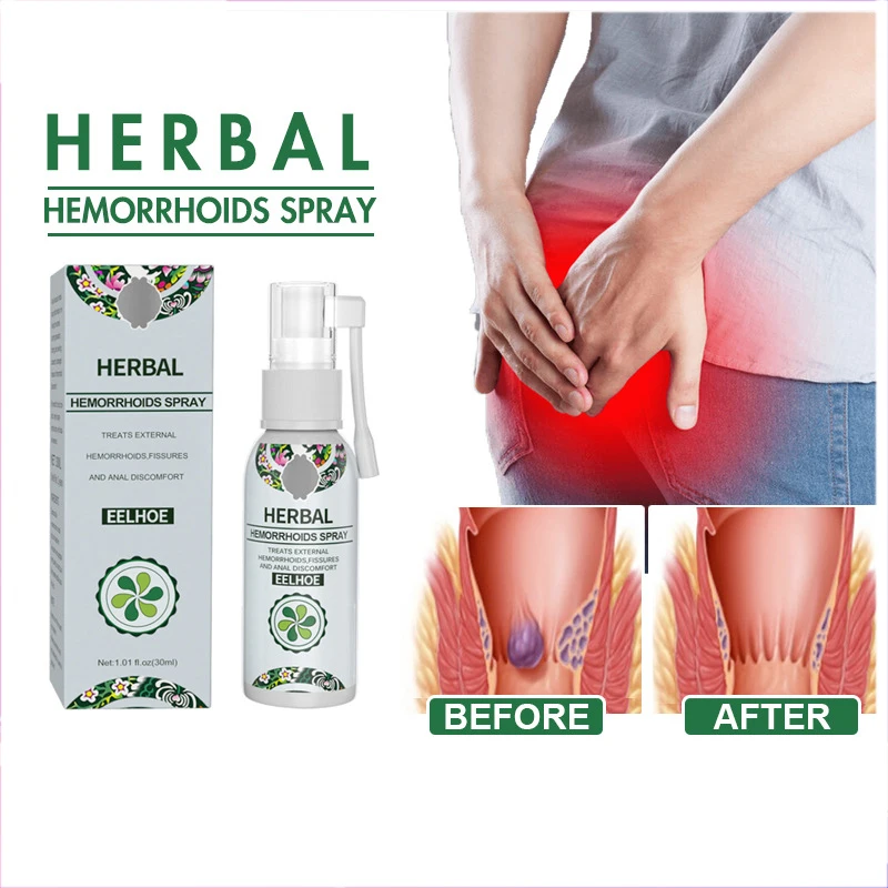 30 мл eelhoe естественных трав, отеки и геморрой дискомфорта успокаивает снимает очищает спрей лучший обработки геморроя