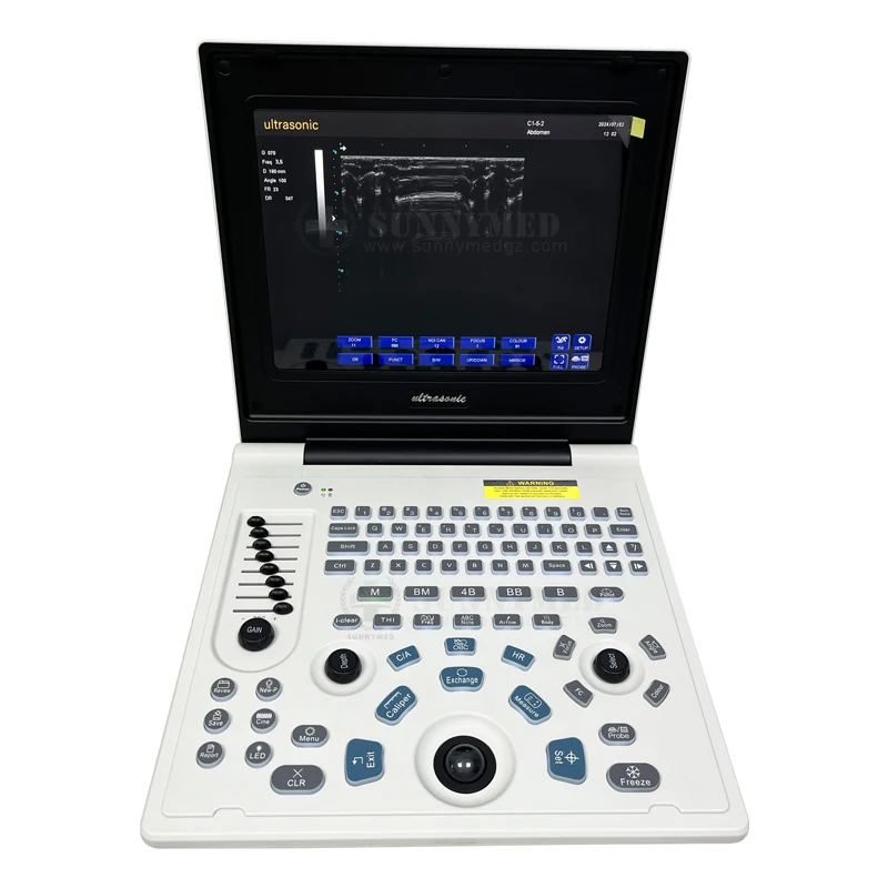 SY-AX50-1 Cardiac OB GYN Echocardiography Machine Full Digital Diagnostic System Black and White Scanners Ultrasound System