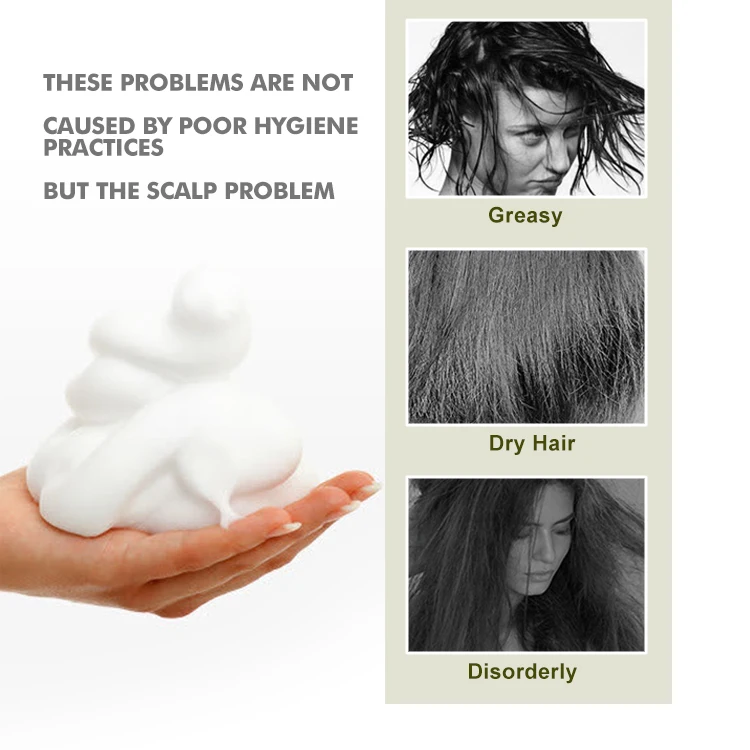 Фирменный натуральный биотин коллагеновый шампунь для роста волос, шампунь и Кондиционер