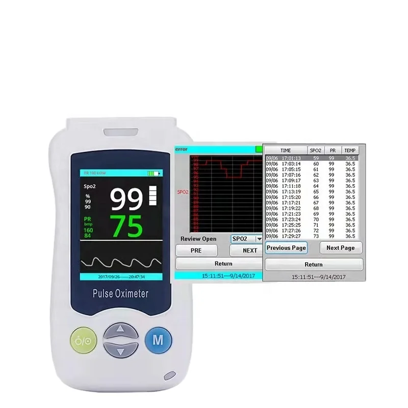 Manufacturer direct sale handheld vascular ultrasound prenatal fetal heart rate monitoring fetal doppler