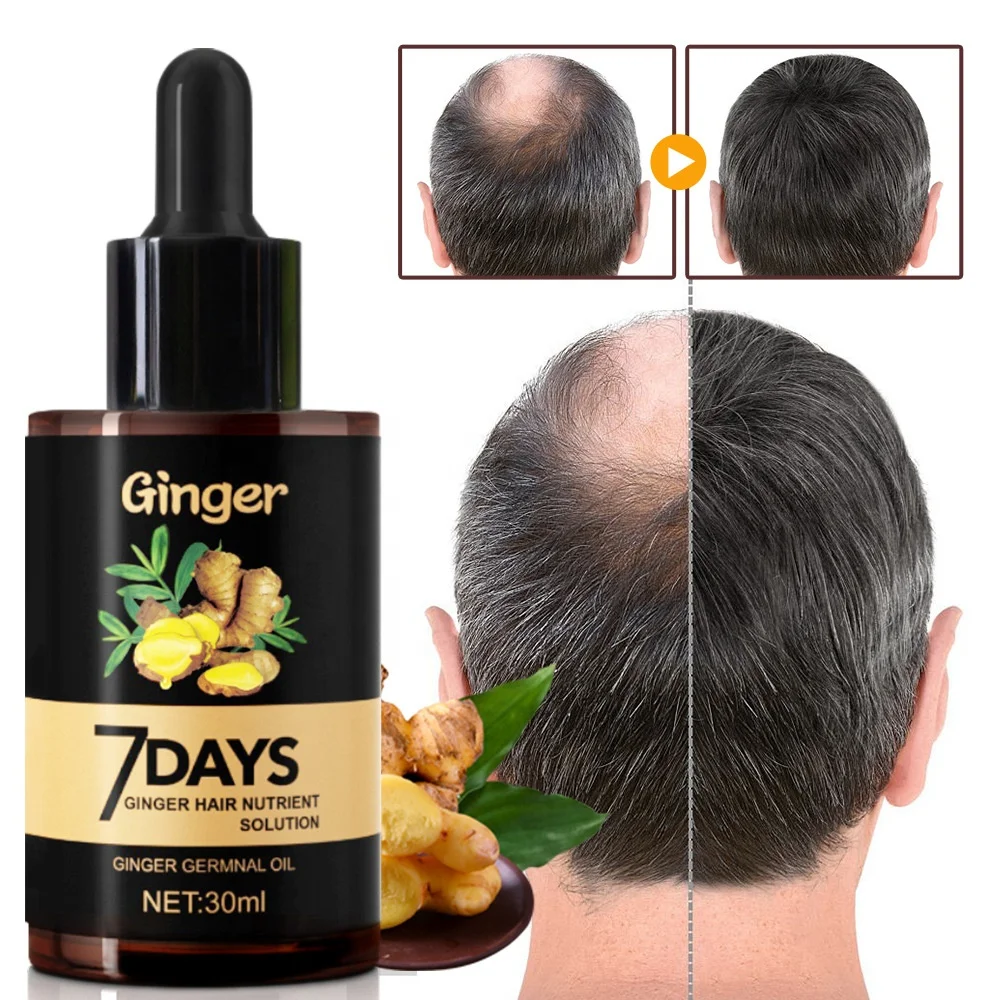 7 Days Natural Germinal Oil Bald Hair  Growth Ginger  Oil for Men
