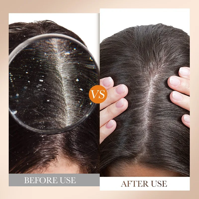 Natural Hair Care Argan Oil Growth Shampoo Conditioner Hair Mask Edge Control Set Dandruff Anti Hair Loss Shampoo
