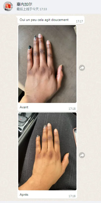 Peeling Oil Skin Whitening Cream And Lotion Carrot Body Whitening Oil