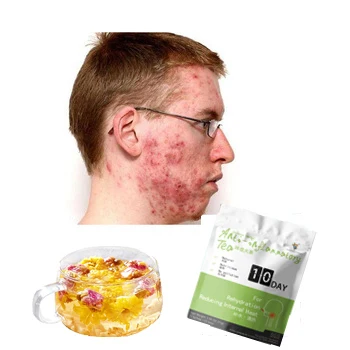 Tea Gift Set Healthy Fit Tea  Hot Sell Beauty Tea