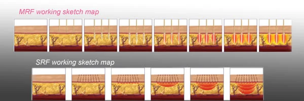 Professional facial lift RF  Microneedle Wrinkle Removal PDT skin tightening beauty facial Beauty machine