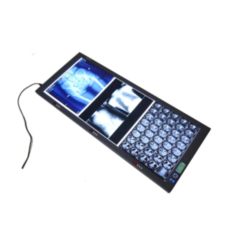 Новый тип медицинской X-RAY коробка для просмотра