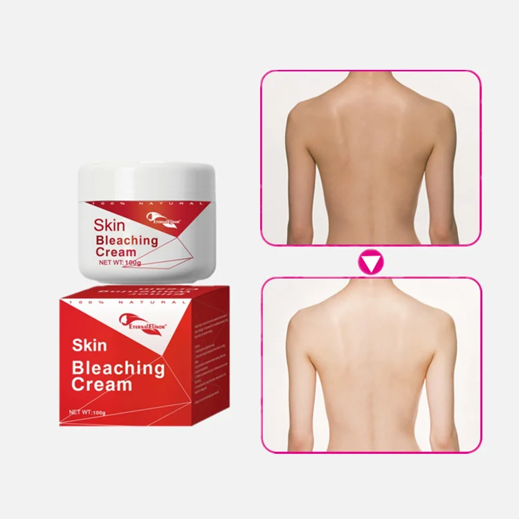 OEM ODM eternal elinor whitening skin anti bleaching set face cream for woman