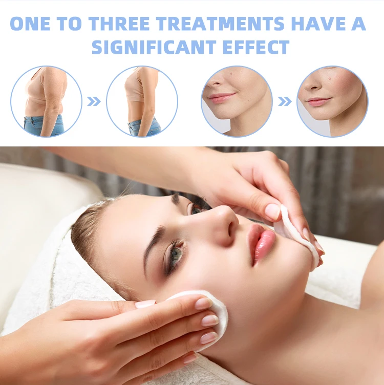 High Intensity Focused Ultrasound Mini Hifu 12d Smas Hifu 11d Portable Hifu Machine