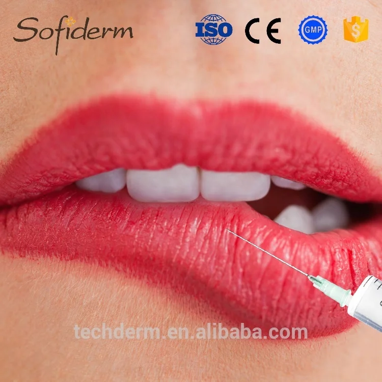 Sofiderm cross linked hyaluronic acid gel filler for lips enhancement