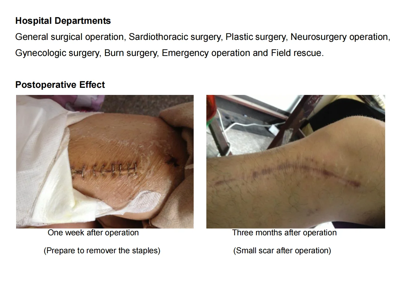 Sterilized Disposable Skin Stapler Manufacture And Wholesale Surgical Circumcision Medical Instrument Surgic  35w 35 W Stainless