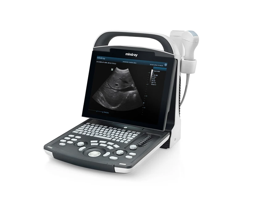 Mindray DP-10 Digital Ultrasonic Diagnostic Imaging System DP 10 portable Ultrasound Machine