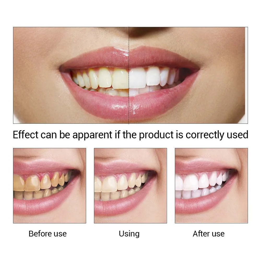 
LANBENA Professional Easy White Teeth Whitening Essence Liquid Oral Hygiene Teeth Cleaning Remove Plaque Stain Brighten Whiten 