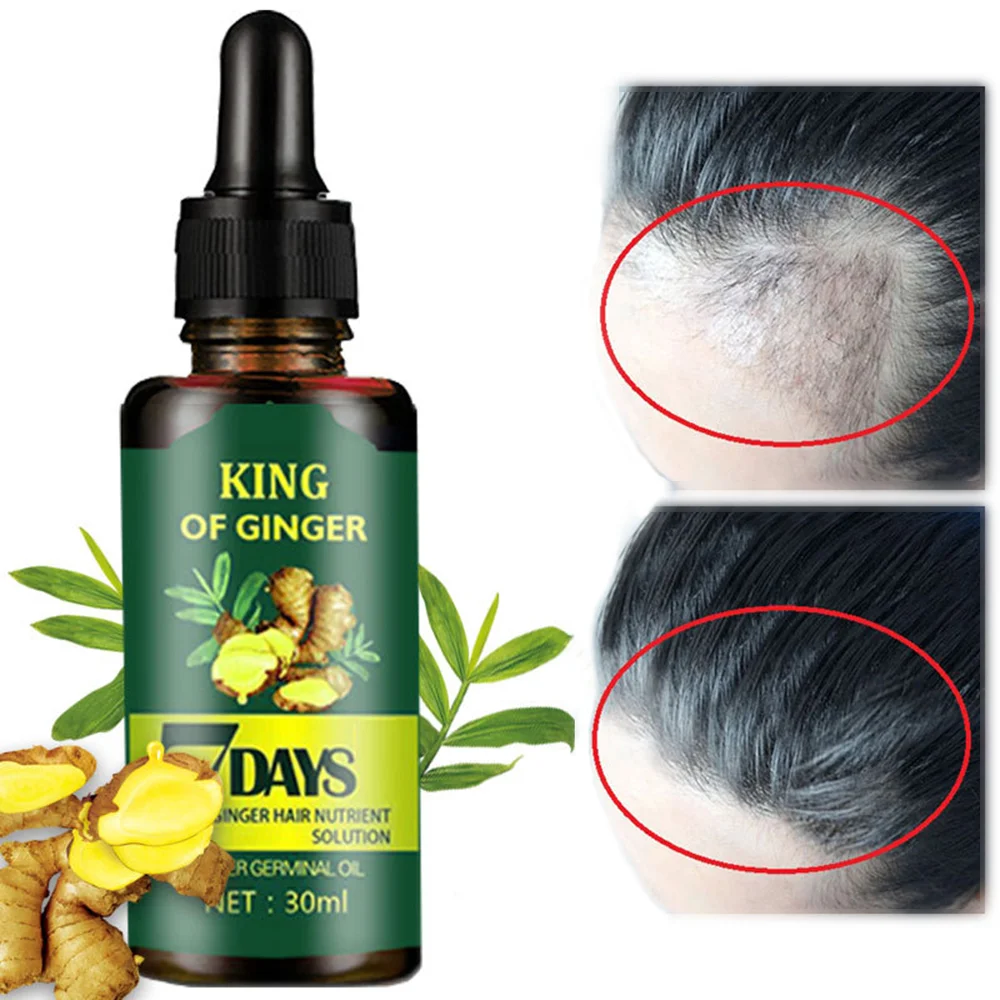 Free Sample 30ML Ginger Hair Oil Mega Growth Healthy Hair Growth Stimulating Oil