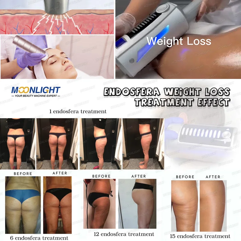 slimming machine weight loss other beauty & personal care products resonance therapy inner roller 1540 rom rpm ball