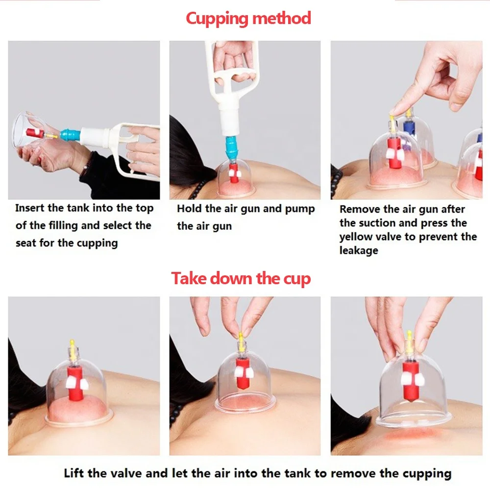 Good Quality 20*10CM Hijama Cups Wholesale Cupping Therapy Suction Pump Gun