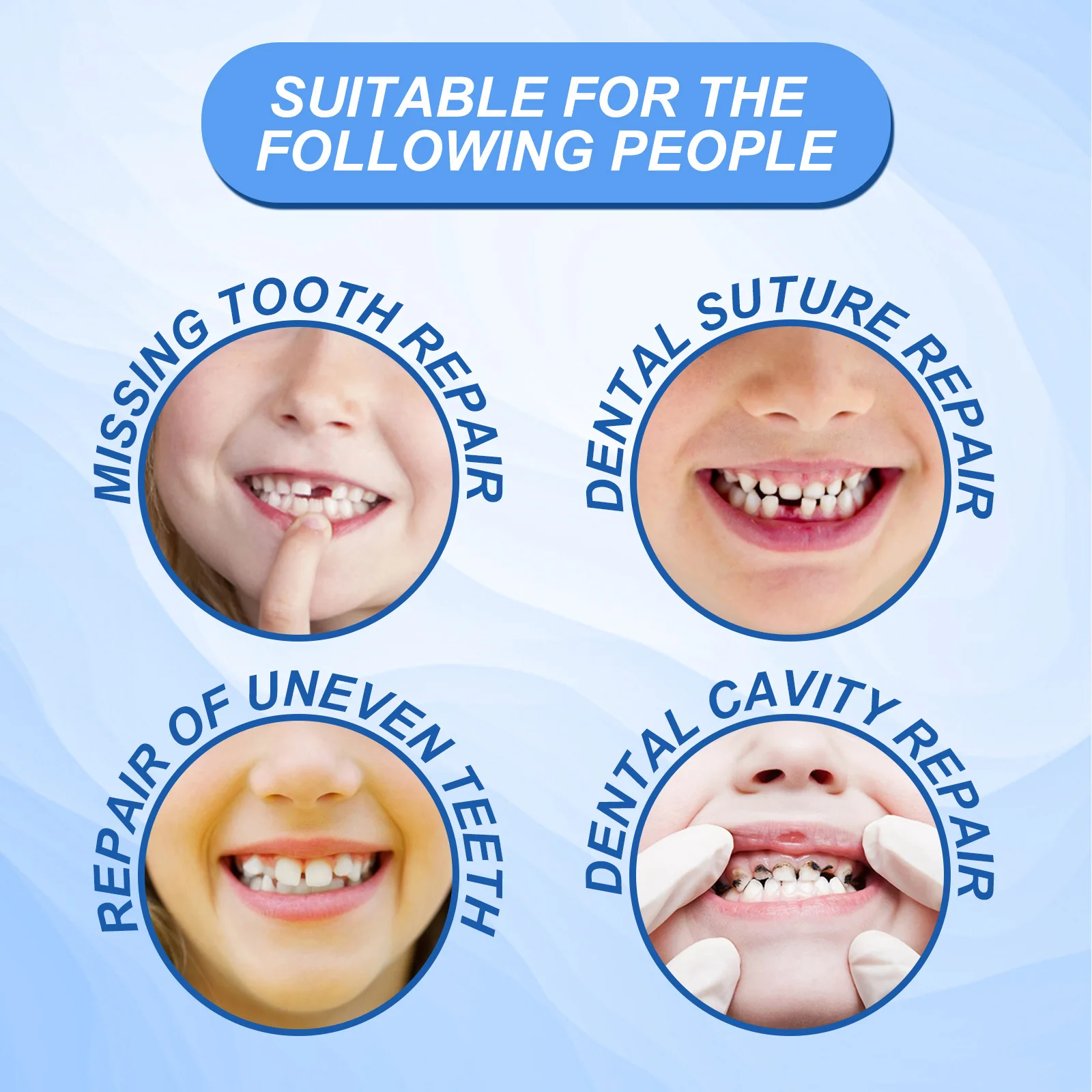 South Moon Modified Teeth Temporary Tooth Filling Tooth FillingGlue Temporary Fit Filling False Filler Glue 30ml