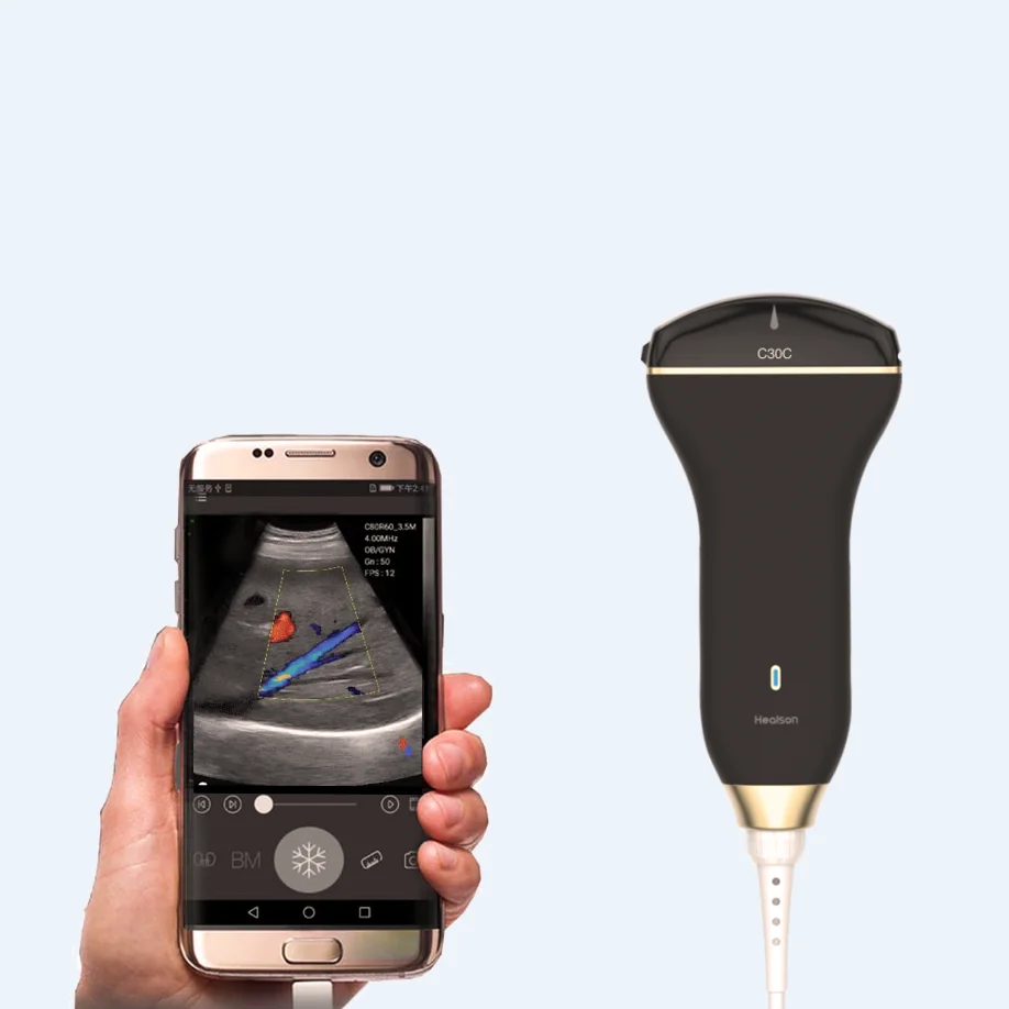  Healson C30C выпуклая Самая Дешевая портативная ультразвуковая USB-машина для смартфона
