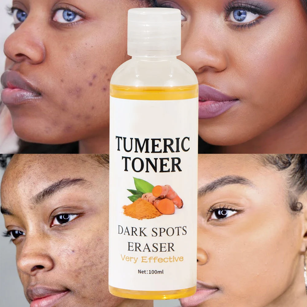 Private Label Turmeric Toner Dark Spots Skin Tone Eraser Corrector Skin Whitening Firming Acne Remove Face Turmeric Toner