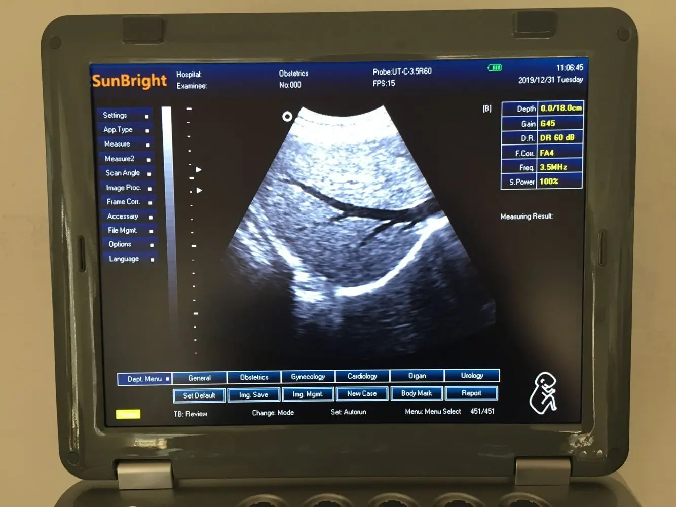 Sunbright SUN-800D ecografo ветеринарный же mindray качество 3D Портативный Беспроводной ультразвуковой