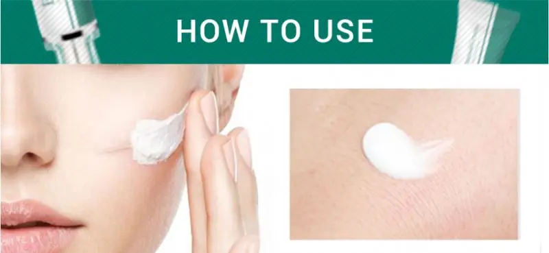 BREYLEE 30g Acne Scar Removal Cream Natural Herbal Skin Repair Acne Treatment Fade Stretch Marks Scar Remover Cream