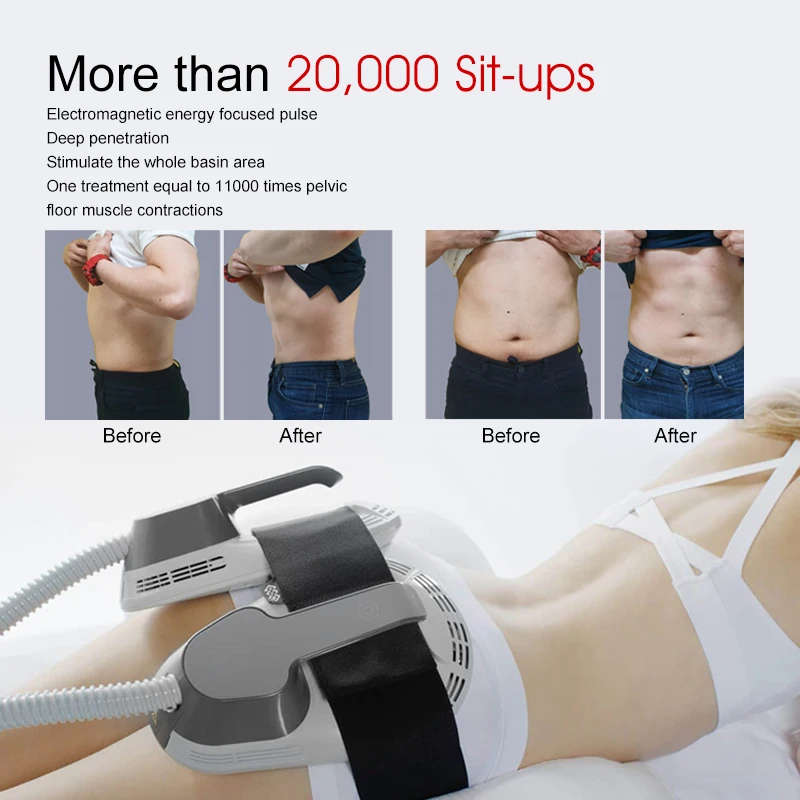Body Sculpt Circslim Non-Invasive Body Shaping Contouring Slimming Electronic Muscle Stimulate Machine EMSLIM /Sculpt