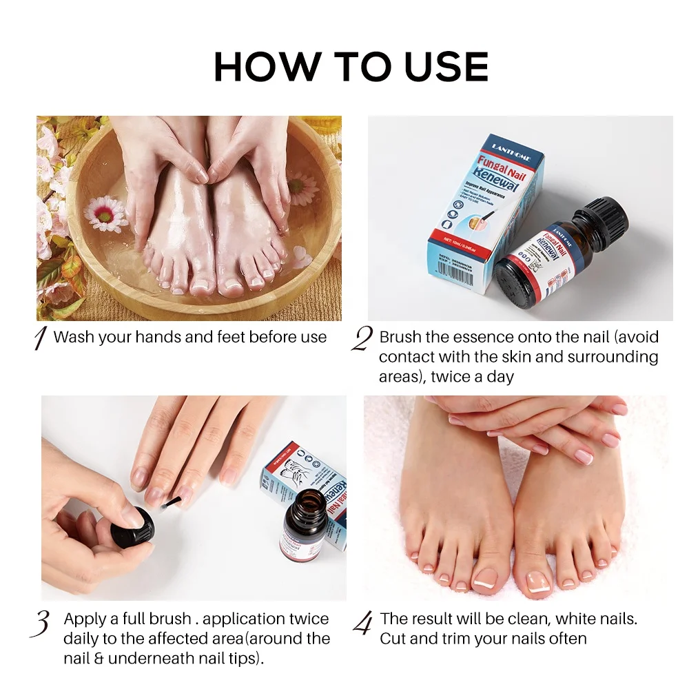 Anti Fungal Nail Foot Care Nail Fungus Pedicure Treatment Home Nail Fungus Treatment Oil Liquid Solution Kit