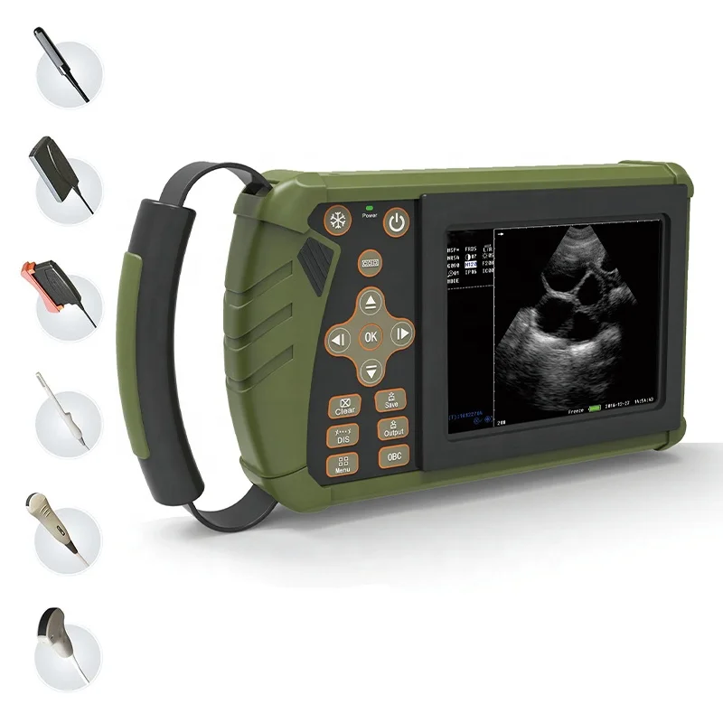 Normal Kidney Size Ultrasound Prostate Bladder Stones Urinary Uterus Gallbladder Lymphoma Spleen Myelolipoma Dog Scanner