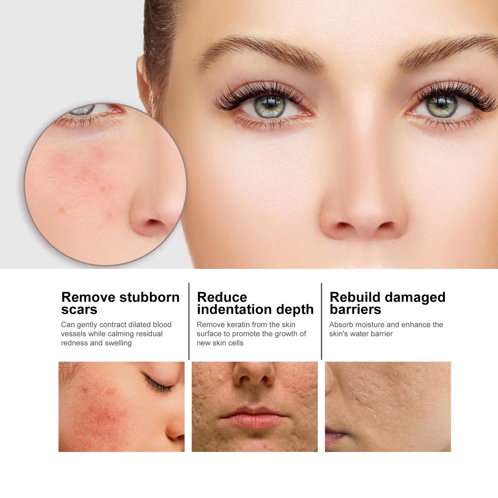 EELHOE Nicotinic Acid Facial Serum Lightening acne Mark moisturizing Pore Contraction Whitening Skin Beauty Serum
