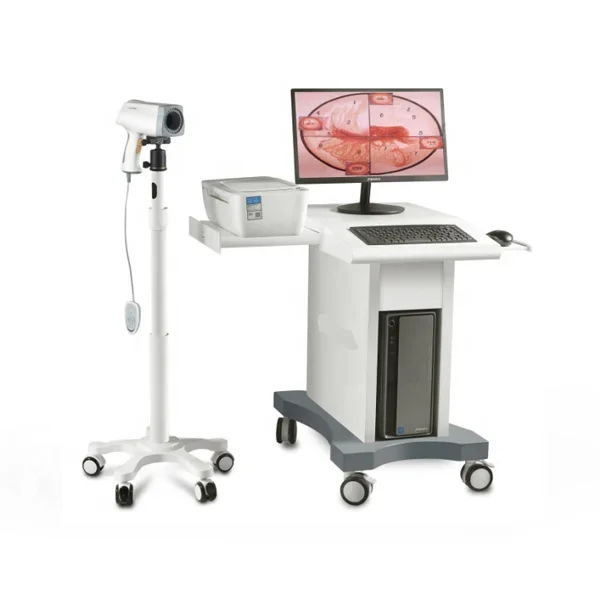 Digital Colposcope Imaging System Medical Vaginal Cervical Exam Portable Colposcope for Gynecology