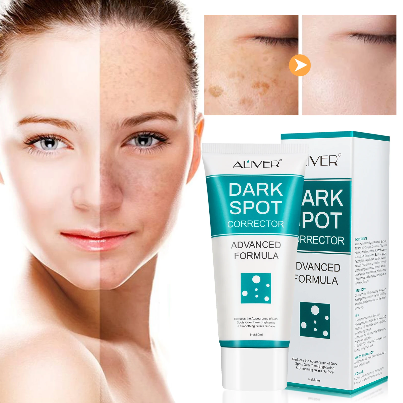 ALIVER Facial Skin Care Dark Spot Corrector Freckle Melanin Spots Removal Cream Nourishing Smoothing Skin Whitening Cream