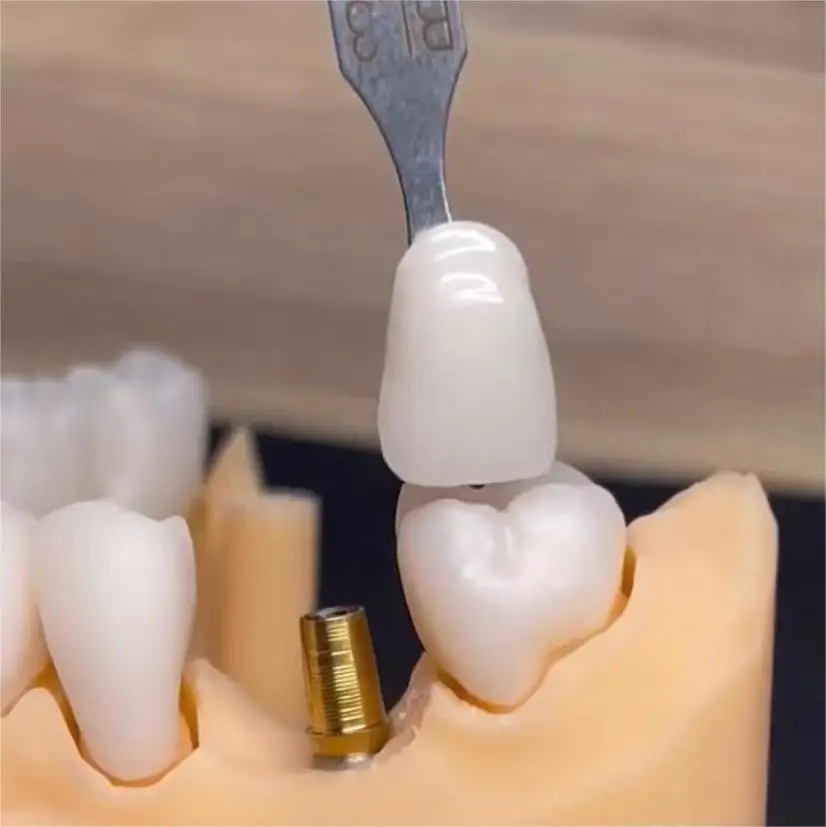 Zahndent cad cam изготовление зубных протезов циркония Многослойные диск стоматологический стоматологическая керамика