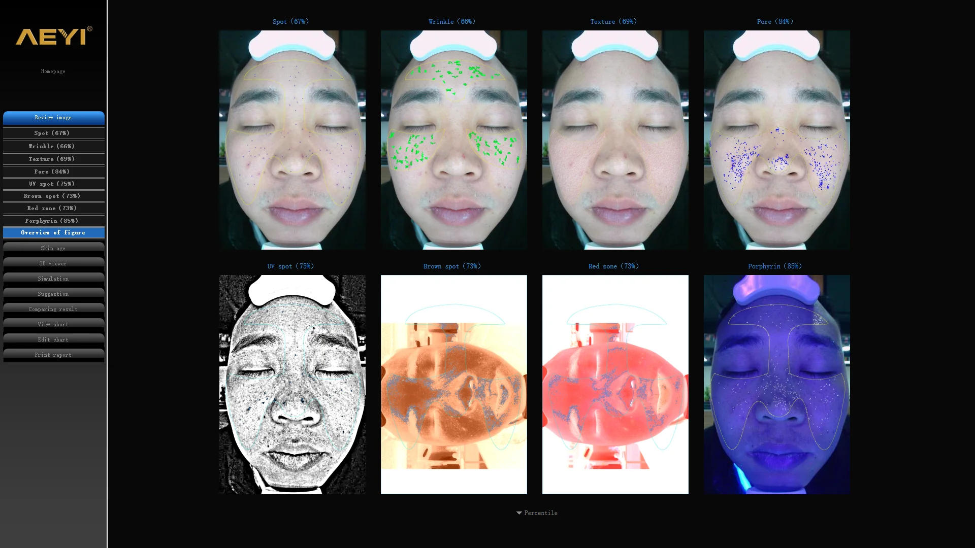 V8 Visia Magic Mirror Facial Skin Analyser Machine  with Woods Lamp for Cosmetics