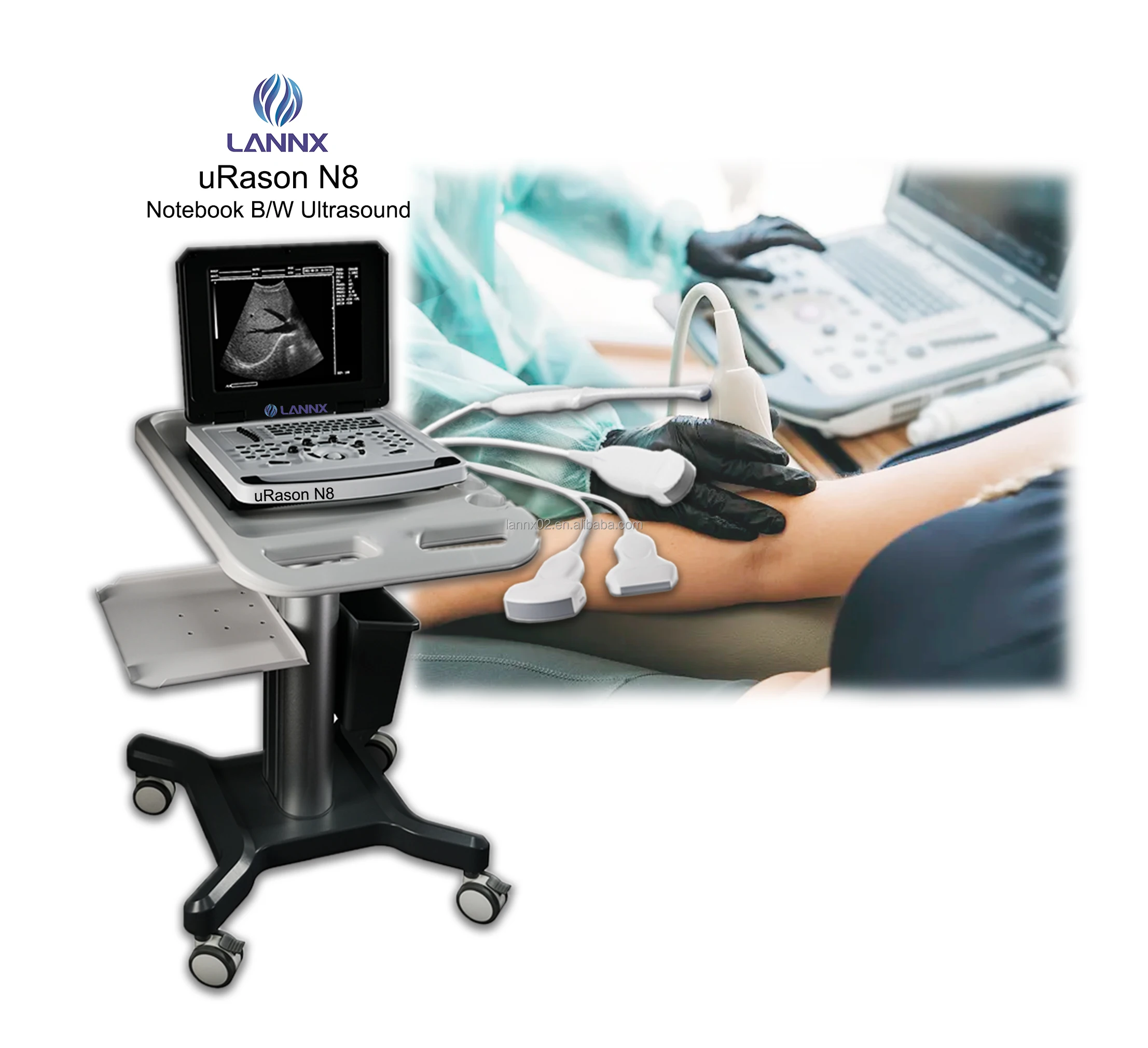 LANNX uRason N8 Medical Portable B/W Ultrasound Scanner for human Ultrasonic Diagnostic Imaging System ecografia portatil