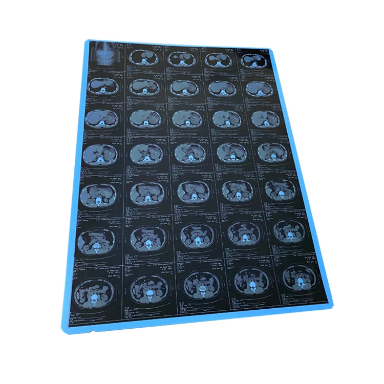China OEM 210um Medical Blue Base X Ray Film in 8x10 14x17 Sheets