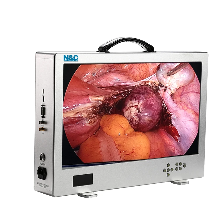 Support Customization Hd 1080p 24 Inch Surgical Integration Medical 4k Endoscope Camera
