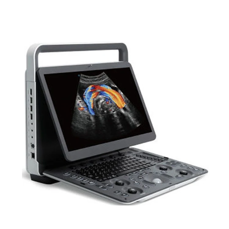 3D 4D Full Digital Doppler Ultrasound Scan Machine /Scanner CE Approved Sonoscape E1EXP Ultrasound Machine