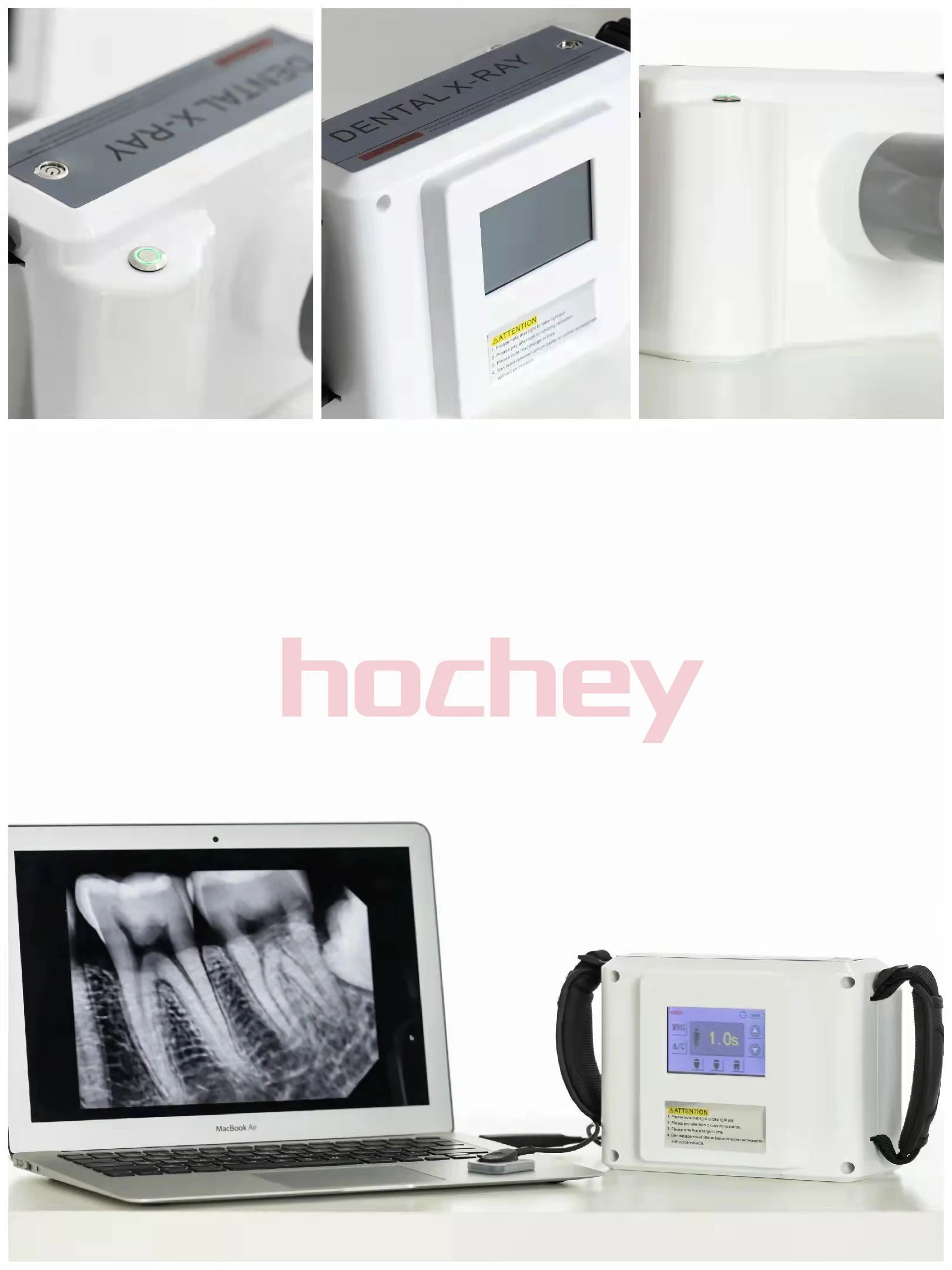 Dental Portable X-Ray Sensor/High Frequency Handy Dental Portable X-Ray Machine /Dental Imaging System Wireless X Ray Machine
