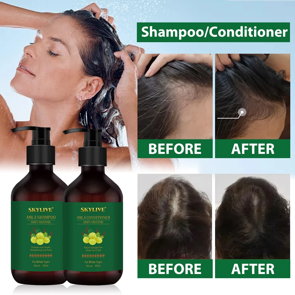 New Popularity Amla Oil Shampoo Set Herbal Extracts And Essences Moisturizer Nature Sampoo Hair Shampoo Hair Care Product
