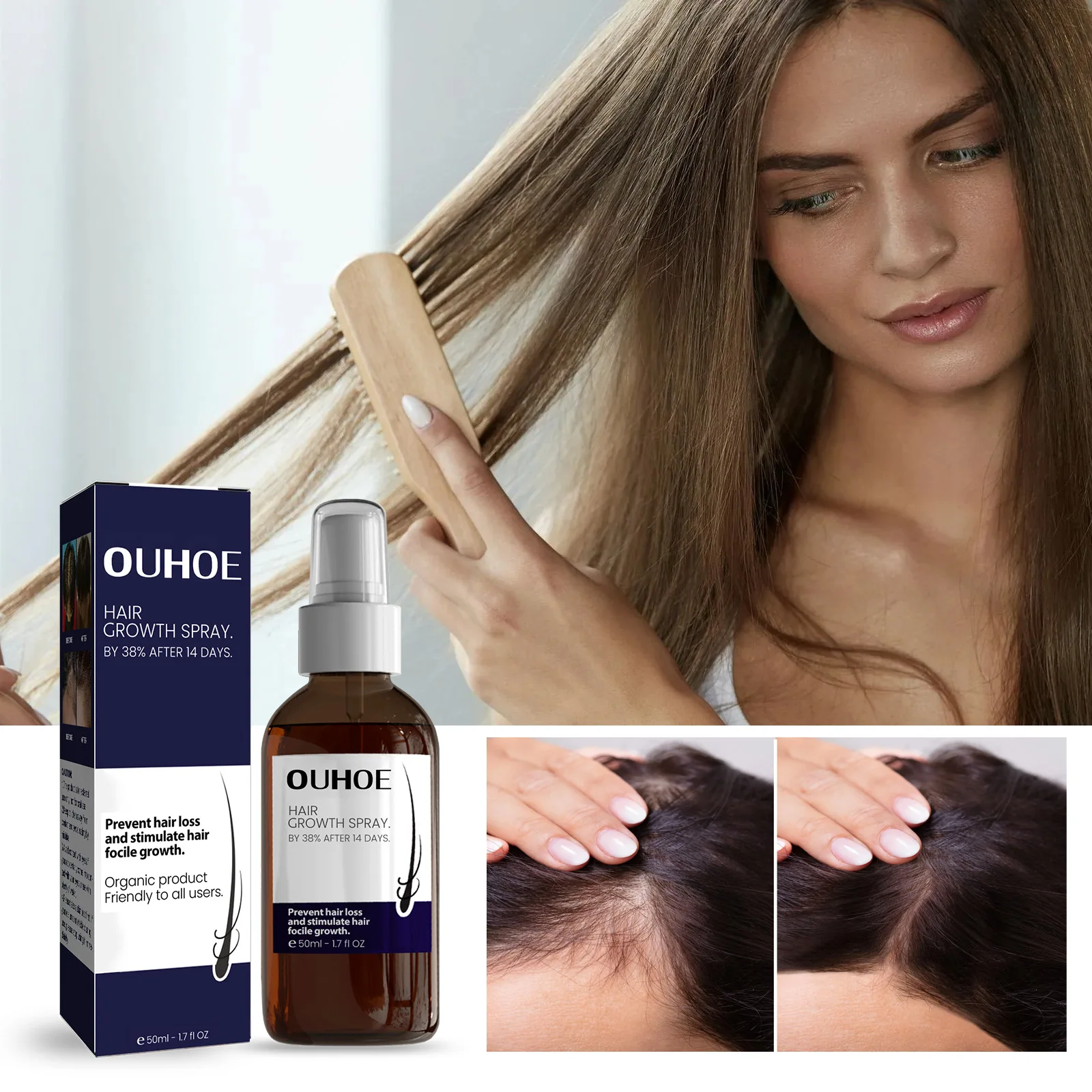 OUHOE Wholesale Moisturizing Scalp Hair Damaged Strong Hair Dense Nourishing Hair Growth Spray