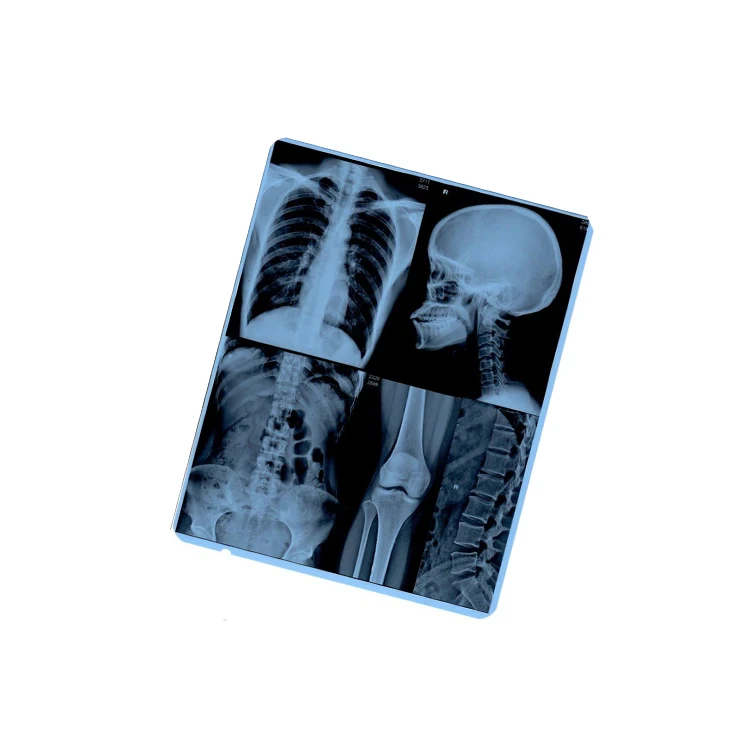 Nanjing Factory Wholesale Accurate And True Image Blue Dental X Ray Film For Kodak Printer