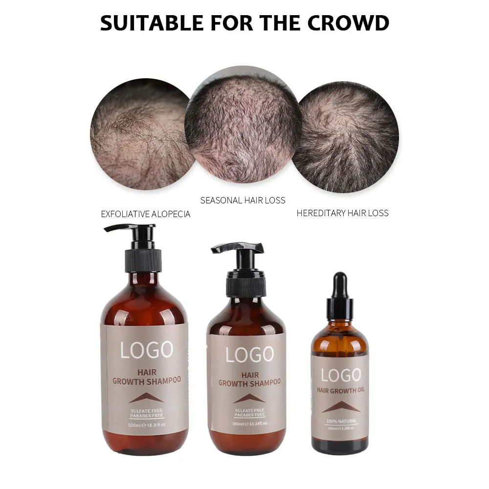 Private Label Batana Oil Organic Hair Regrowth 100% Natural Gginger Promote Hair Growth Shampoo OEM