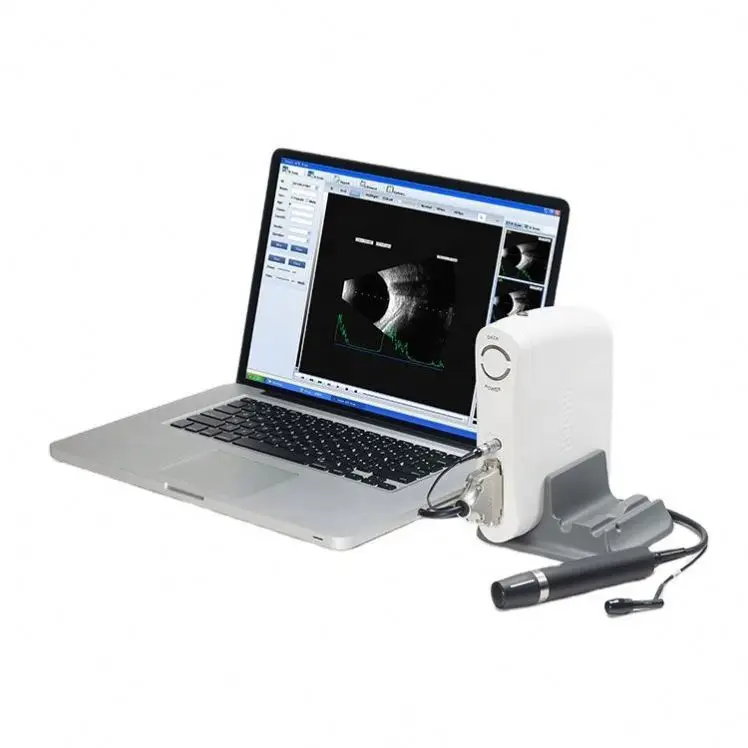 Factory Price Ophthalmic Ultrasound A Scan Ophthalmology Machine AB Scanner