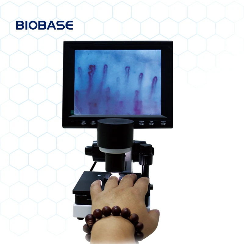 BIOBASE China Microcirculation Microscope WXH-8 capillary microscope/darkfield live blood analysis microscope