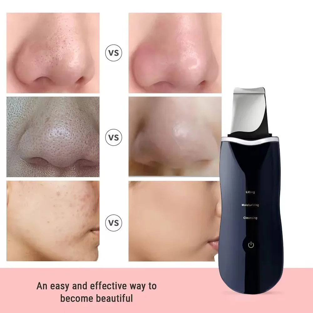 New Ultrasonic scrubber Deep cleansing Face scrubber Cleansing spade Exfoliating scraper Peeling beauty instrument