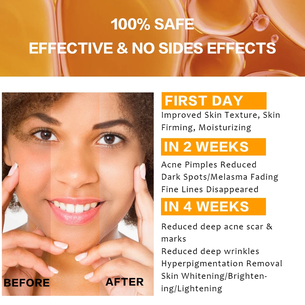 Wholesale Skincare Products Anti Melasma Skin Whitening Niacinamide Vitamin C Serum For Face