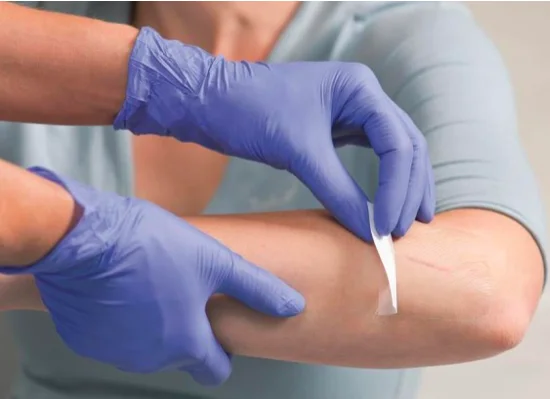 Waterproof Surgical Film Transparent Adhesive Dressing For Negative Pressure Wound